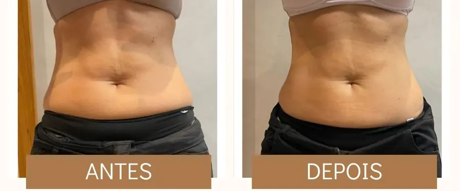 antes e depois 2