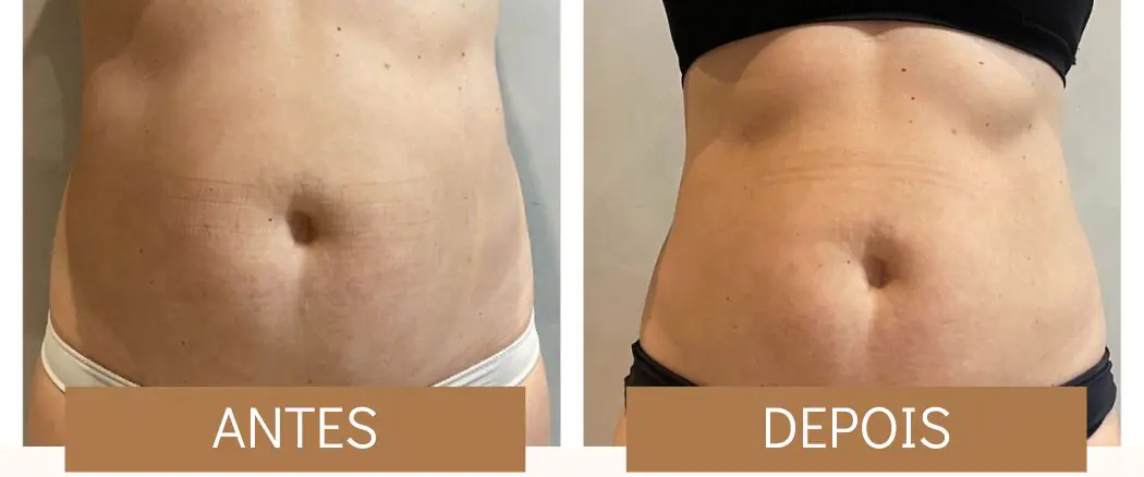 antes e depois 07